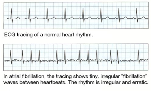 EKG%202%20with%20new%20text%20and%20smaller%20jpg.jpg